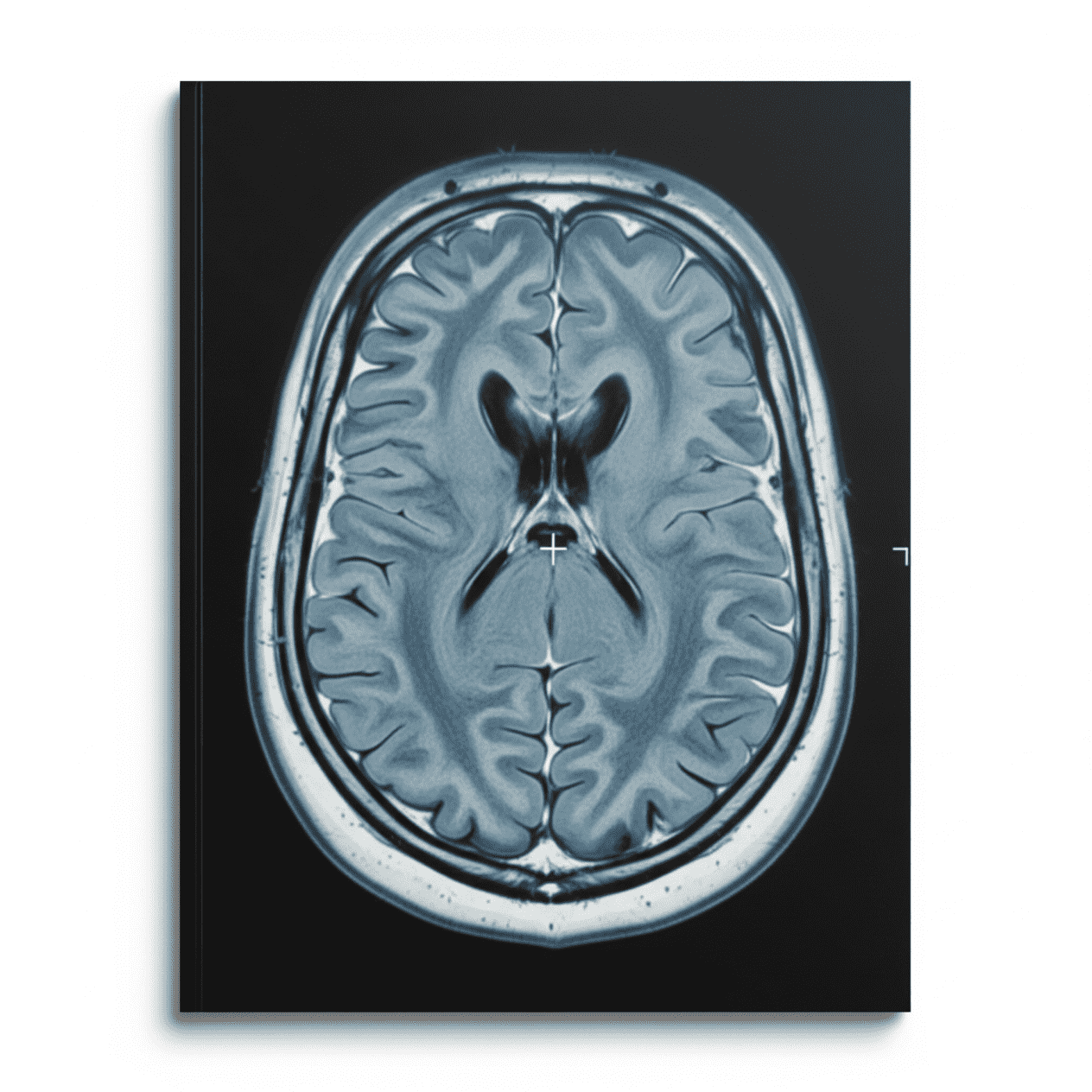 Expert Translation of Medical Imaging Reports – MRI, CT, Radiology