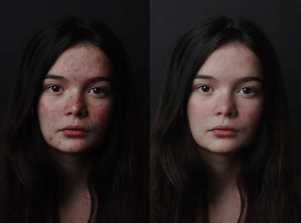 Correcting blemishes with Photoshop
