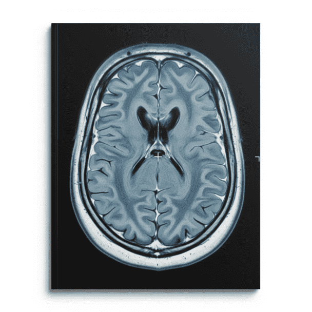 Expert Translation of Medical Imaging Reports – MRI, CT, Radiology