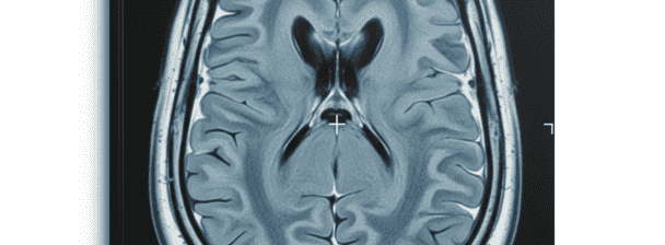 Expert Translation of Medical Imaging Reports – MRI, CT, Radiology
